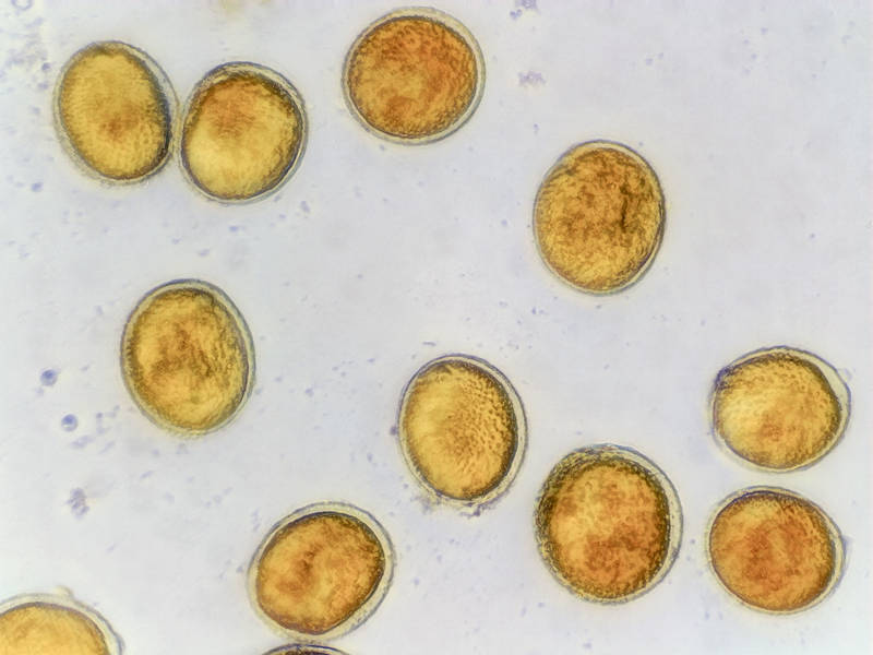 Spores (x100 objective) of white crust fungus <B>Dendrothele candida</B> from bark of a large live oak at the entrance, collected a day before in Somerville Lake State Park. Texas, January 2, 2023