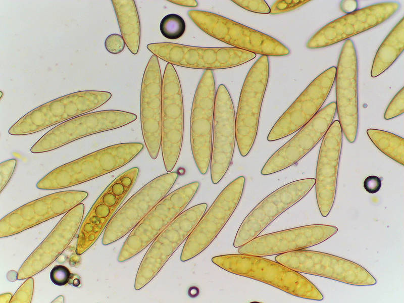 Spores (at low magnofication) of Ascomycete mushroom <B>Chorioactis geaster</B> collected a day before in Birch Creek Unit of Somerville Lake State Park. Texas, January 2, 2023